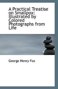 A Practical Treatise on Smallpox