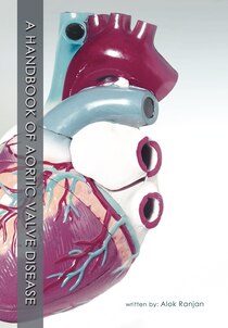 A Handbook Of Aortic Valve Disease